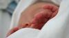 Un bebeluș respiră pentru prima dată singur după ce a fost supus unui transplant rar de plămâni