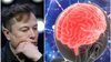 Eşec pentru Elon Musk. Primul cip implantat în creierul unui pacient a suferit un incident neaşteptat