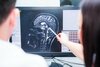 40% din cazurile de demență și 60% din atacurile cerebrale ar putea fi prevenite. Un test simplu poate ajuta la (...)