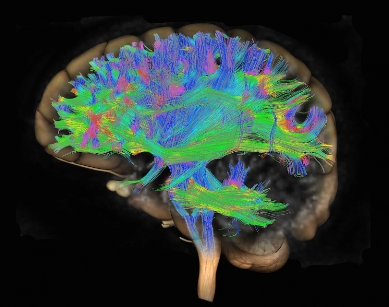 Aerul pe care îl respiri îți poate fura memoria: Descoperire șoc în lupta cu boala Alzheimer