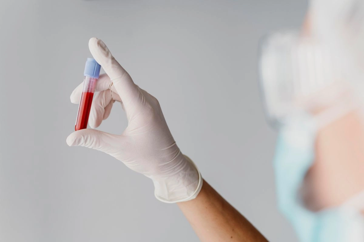 Se întrevede un viitor fără cancer? Testul de sânge care depistează până la 50 de tipuri de tumori a obținut (…)