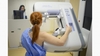 În Statele Unite, se recomandă efectuarea mamografiilor începând cu vârsta de 40 de ani
