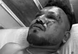 Singurul supraviețuitor din avionul prăbușit în India a făcut declarații! Cum a reușit să își salveze viața