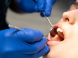 Eurostat: Românii sunt printre cei mai afectaţi din UE în privinţa accesului la servicii de îngrijire stomatologică