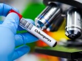 Cum se traduce ”chikungunya”, virusul care reaprinde teama unei pandemii. Se referă la un simptom înfiorător al (…)