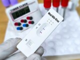 Crește numărul de cazuri de infecții cu virusul West Nile. INSP trage un semnal de alarmă