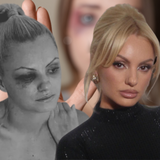 Alexandra Stan, mesaj pentru victimele violenței domestice, după moartea Teodorei Marcu: „Mie mi s-a întâmplat acum (…)