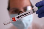 Alertă infirmată la Reșița! Testul pentru hantavirus al pompierului ISU Caraș-Severin a ieșit negativ