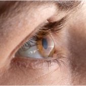 Spania: O echipă de cercetători a creat corneea artificială din solzi de pește. În viitor, aceasta ar putea fi&nbsp;(…)