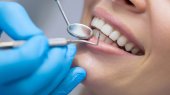 Medic stomatolog, semnal de alarmă: Doar 27% dintre români au dentiție completă