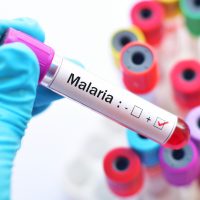 BUCUREȘTI: Caz confirmat de malarie