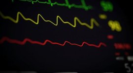 Un medic cardiolog dezvăluie ce să NU mănânci dacă vrei să eviți infarctul