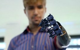 I-a promis în copilărie prietenului său că îi va construi un braț robotic, iar acum a reușit. Invenția&nbsp;(…)