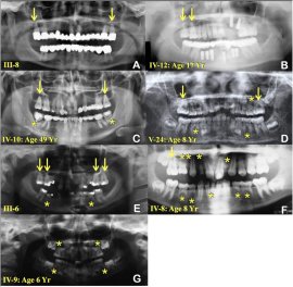 A fost descoperită cauza pentru o mutație genetică misterioasă