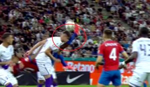 Cum arată faţa lui Mario Tudose, după ce a fost lovit în plină figură de Siyabonga Ngezana, în FCSB – FC Argeş 0-2