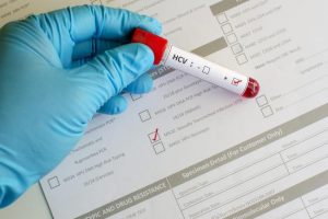 Testare gratuită a virusului hepatic de tip B şi C pentru persoanele asigurate şi neasigurate care prezintă semne de (…)