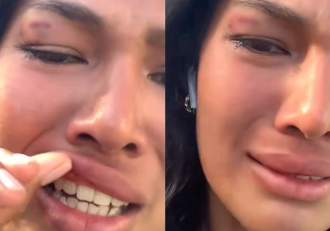 Influenceriță bătută pe stradă fără niciun motiv. A fost lovită în față în repetate rânduri de un străin