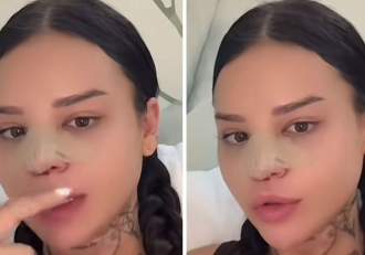 Diandra Doris, fosta ispită de la Insula Iubirii, pe mâna esteticianului! La ce intervenție a apelat