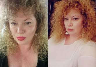 Oana Lis a ajuns la spital! Soția fostului edil și-a rupt mâna