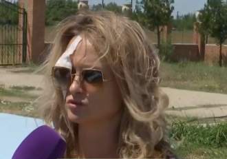 Amalia Bellantoni își strigă durerea! Furtuna severă i-a distrus tot ce a avut! Vedeta a suferit și răni în zona ochilor