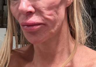 O vedetă TV a aflat de ce are fața distrusă! Inițial a crezut că era vorba de un parazit