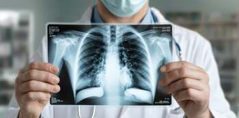 Pandemia de Covid-19 a avut un impact mai mare asupra sănătăţii femeilor decât a bărbaţilor