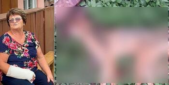 Femeie din Iaşi, atacată de un şacal turbat în propria curte: 
