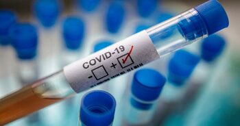 COVID-19 de lungă durată: Virusul persistă în creier