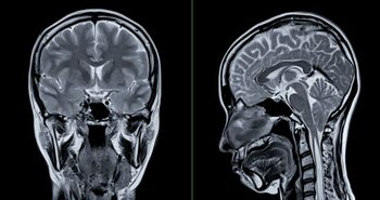 Sfatul neurologului: La ce obiceiuri să renunțăm pentru un creier sănătos?