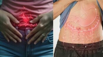 Cum scapi de balonare și gaze! Gastroenterologii susțin că așa vă simțiți mai bine în fiecare zi