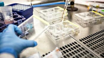 Un test revoluționar detectează endometrioza în 10 minute