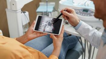 Implanturi dentare cu tehnologii de ultimă generație pentru rezultate precise și durabile