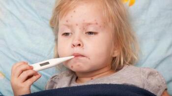 Rujeola în zilele noastre, la niveluri ca acum 50 de ani. Rata de vaccinare în rândul copiilor, în scădere