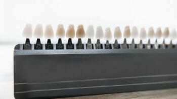 Upgrade Dental: estetica dentară redefinită prin soluții moderne