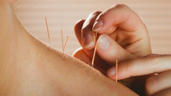 Acul din oțel care a scris istorie: cele mai vechi ace de acupunctură, descoperite într-un mormânt imperial din China