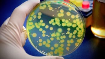 STUDIU/ Oamenii de ştiinţă au potenţat efectul antibacterian al oţetului cu ajutorul nanoparticulelor