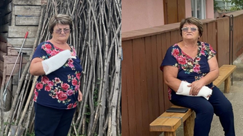 Maria, o femeie din Iași, a trecut prin clipe de coșmar, după ce a fost mușcată de un șacal turbat! S-a ales cu răni (…)