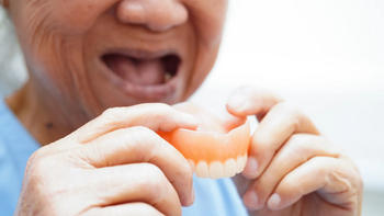 Renunță la proteza mobilă! La Ideal Dental, zâmbetul complet începe chiar din prima zi