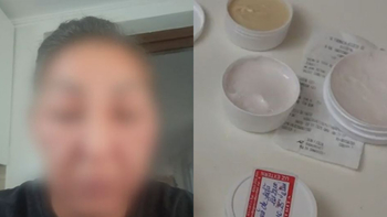 O femeie a ajuns în stare gravă la spital, după ce a folosit o cremă de față: “M-am trezit desfigurată”. Ce conținea (…)