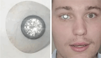 Povestea tânărului care și-a pus un diamant de 2 milioane de dolari în loc de ochi: ”A adus o lumină nouă în viața mea”