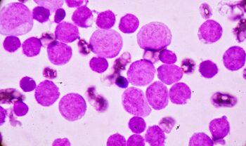 Formele agresive de cancer ar putea fi oprite de un vaccin experimental
