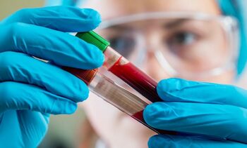 Un simplu test de sânge ar putea prezice scleroza laterală amiotrofică cu zece ani înainte de simptome