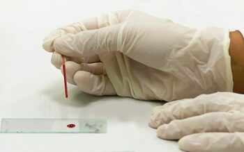 Cercetătorii încearcă să creeze „sângele de aur”, grupa sanguină pe care o au doar 50 de oameni din toată lumea