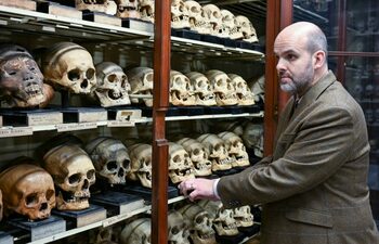 „Camera craniilor” de la Universitatea din Edinburgh dezvăluie o istorie neplăcută