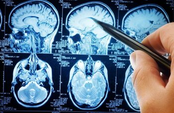 Oamenii de știință descoperă un circuit cerebral care poate opri durerea cronică