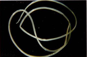 Medicii au găsit un vierme de 11 cm sub pleoapa unei femei