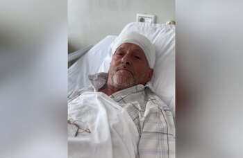 Bărbat de 67 de ani, salvat de medicii din Iași. Acesta s-a prezentat cu o tumoră cerebrală uriașă, de aproximativ 10 cm