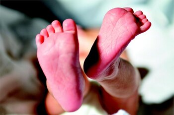 Boala genetică rară care poate fi depistată la naștere. E nevoie de screening. „Mișcarea, locomoția, respirația și (…)