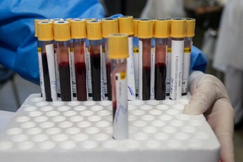 Un test de sânge pentru mai mult de 50 de tipuri de cancer ar putea contribui la accelerarea diagnosticării – studiu