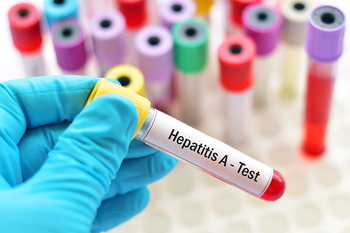 UPDATE: Focare de hepatita A în 22 localități din Bihor: aproape 450 de îmbolnăviri, confirmate
